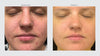 Blemish Control Serum