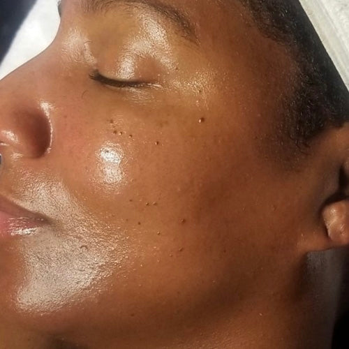 Gentle Resurfacing Serum