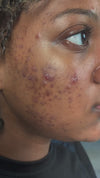 AHA/BHA Clarifying Pads