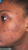 AHA/BHA Clarifying Pads