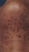 Renew (Retinol)