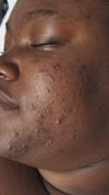 Brightening Pads